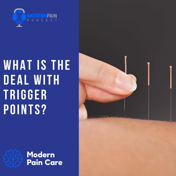 What Is The Deal With Trigger Points?