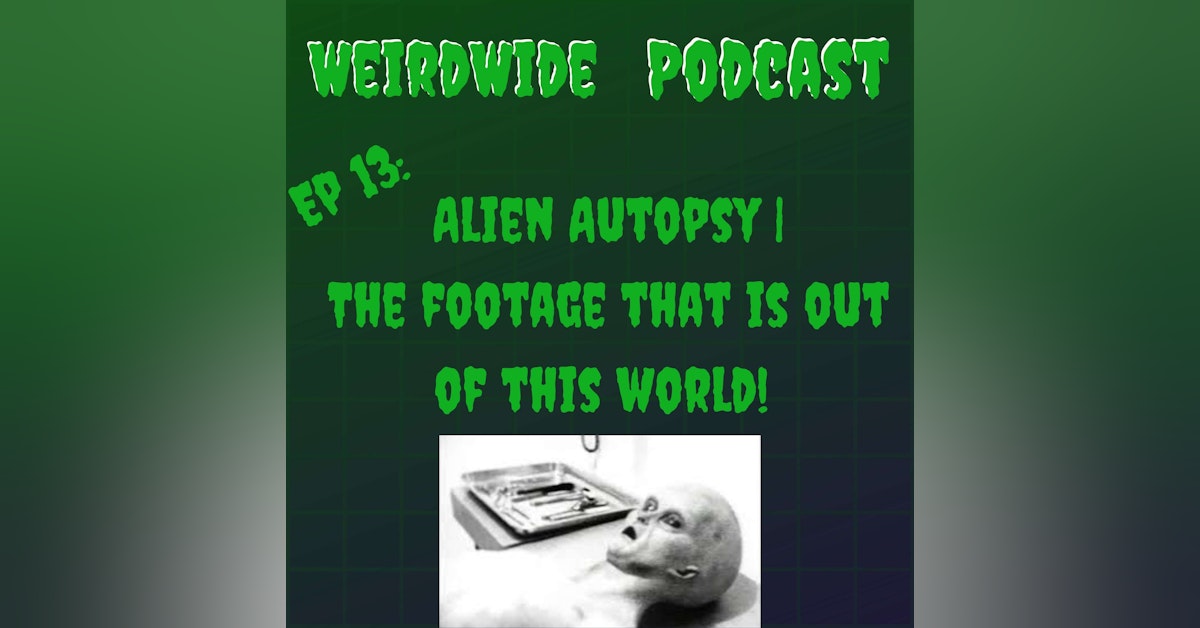 Alien Autopsy | The Footage That is Out of This World!