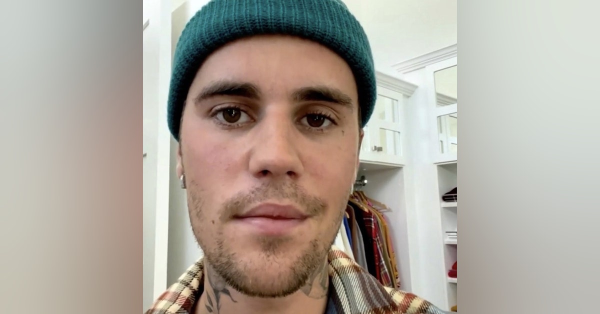Justin Bieber shares update after revealing his face is partially paralyzed