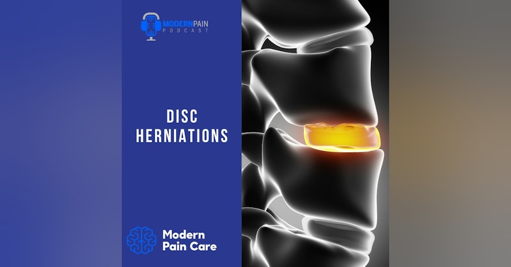 Disc Herniation