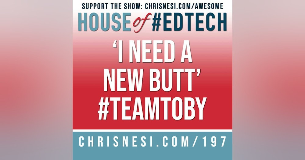 'I Need A New Butt' #TeamToby - HoET197