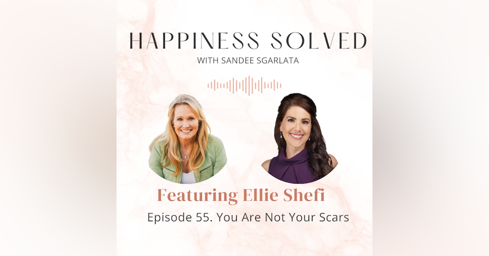 55. You are not your scars: Interview with Ellie Shefi