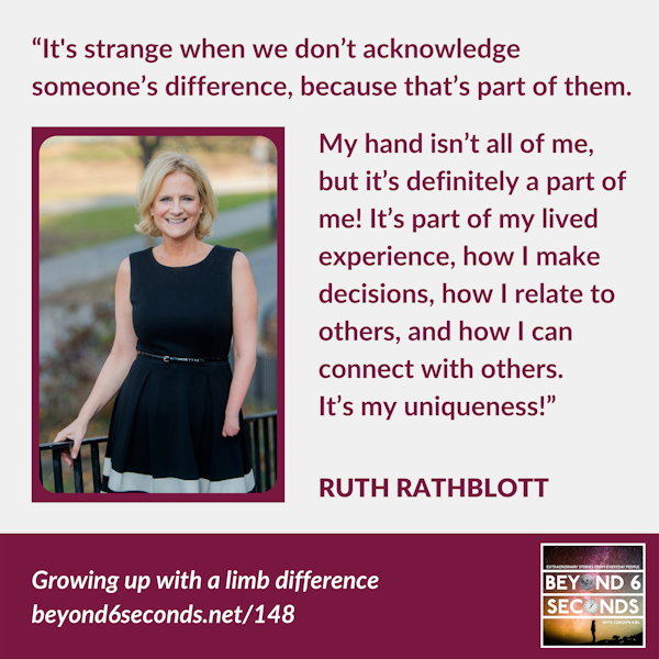 Limb difference, disability and workplace diversity – with Ruth Rathblott Image