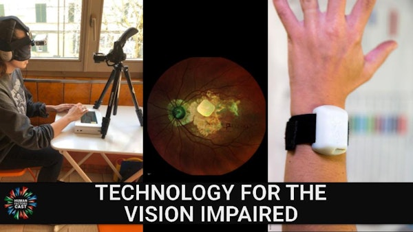 E200 - Technology for the Vision Impaired Image