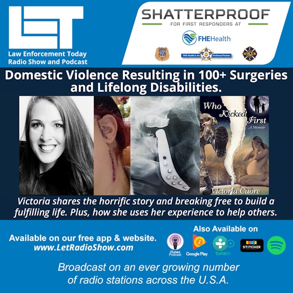 S6E37: Domestic Violence Resulting in 100+ Surgeries  and Lifelong Disablities. Image