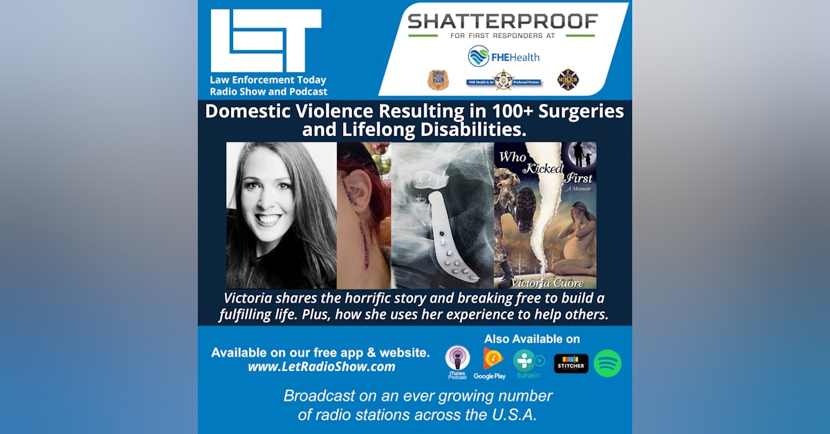 S6E37: Domestic Violence Resulting in 100+ Surgeries  and Lifelong Disablities.